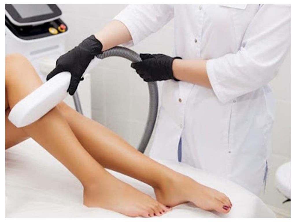 LAZER EPİLASYON HANGİ VÜCUT BÖLGELERİNE YAPILABİLİR?